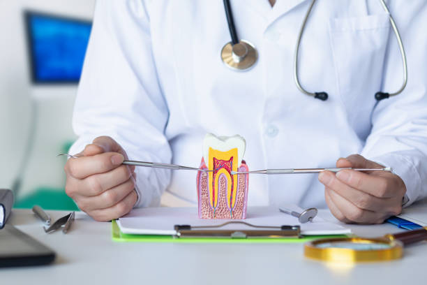 Best Knocked-Out Tooth (Avulsed Tooth) Treatment in Niagara University, NY